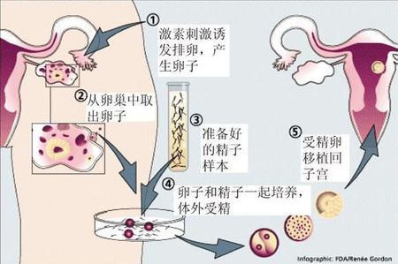 试管代孕包成功男孩生殖中心